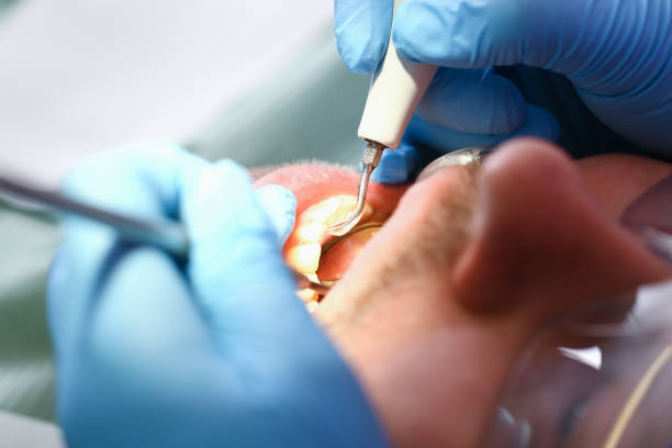 Best Broken or Chipped Tooth Repair in Mount Holly, NC