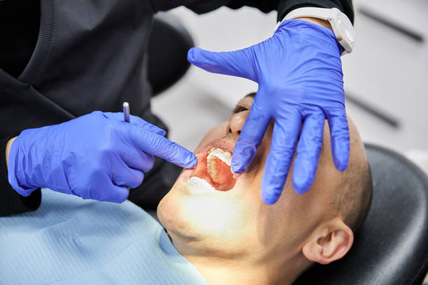Best Dental Abscess Treatment in Mount Holly, NC